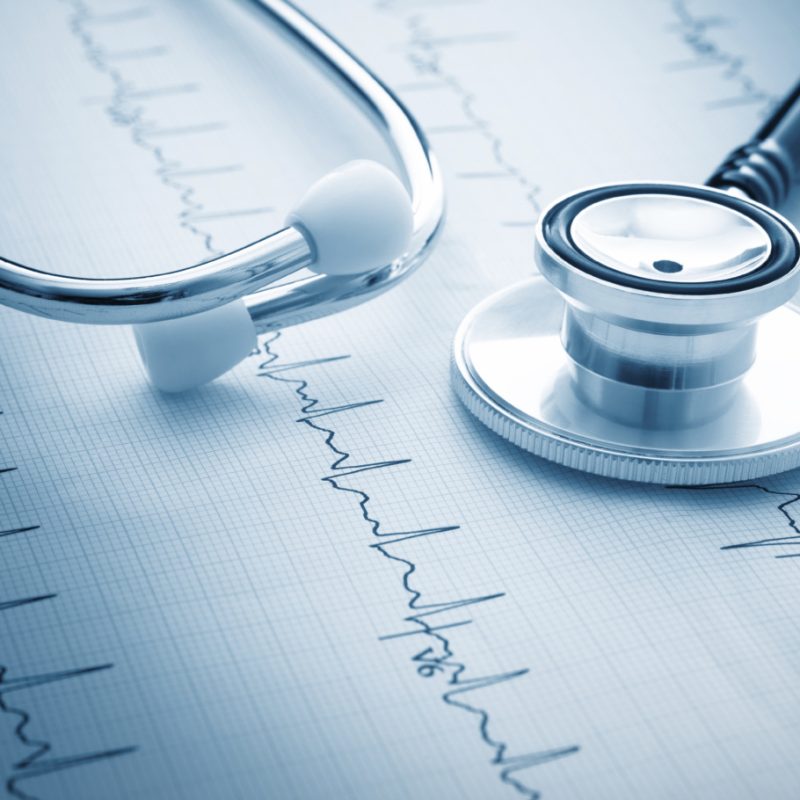 stethoscope resting on an EKG