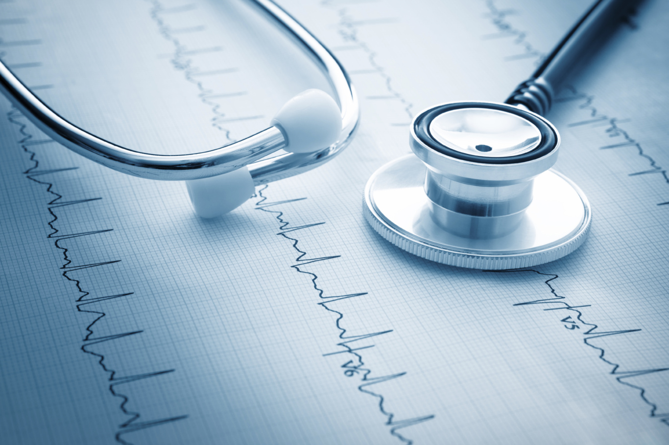 stethoscope resting on an EKG